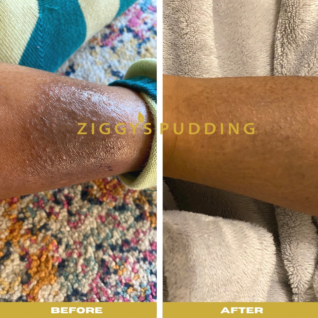 Baby Body Butter - Ziggy's Pudding