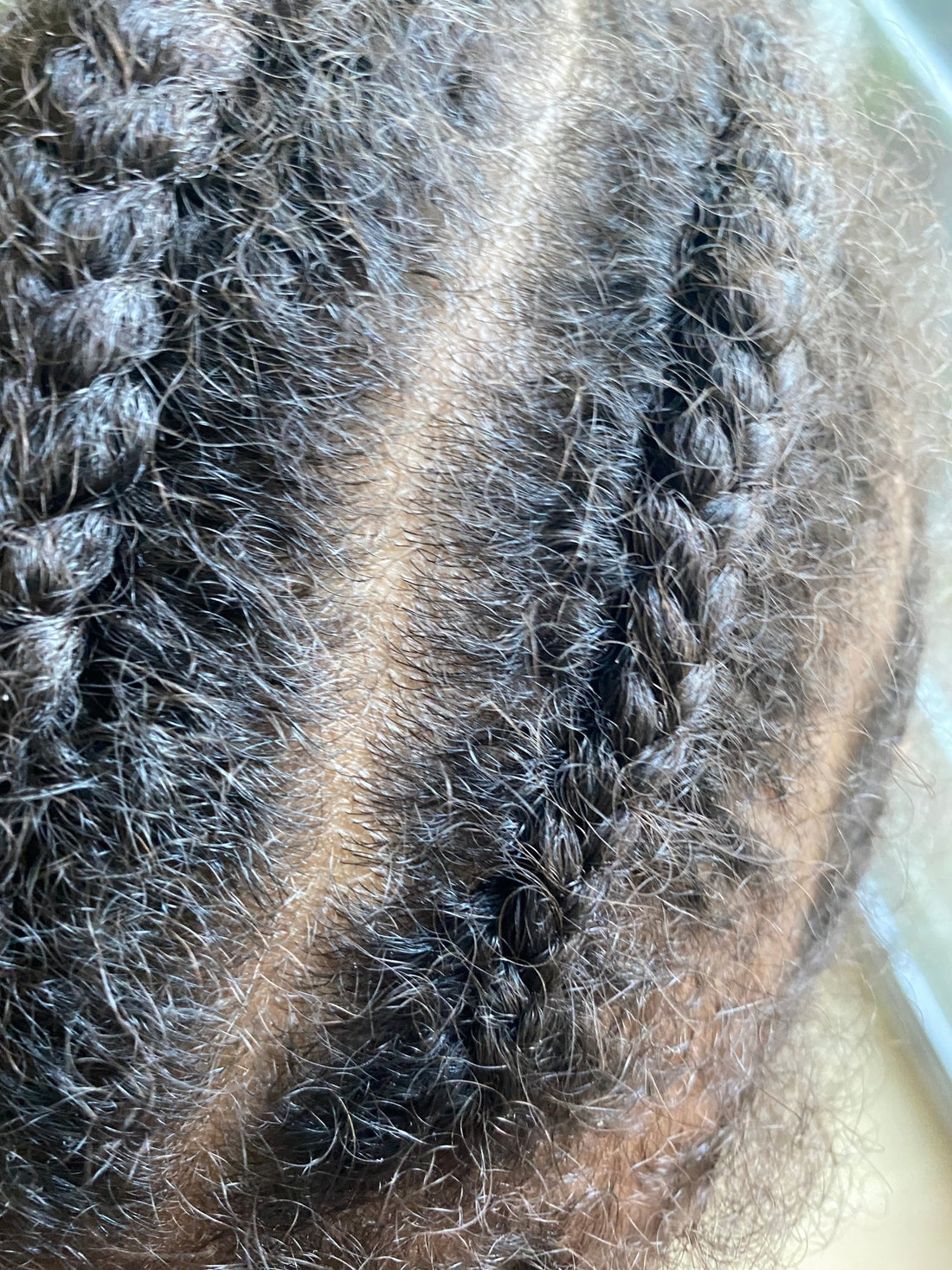 How to care for your baby's scalp - Ziggy's Pudding
